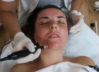 Šta je dermapen - Foto kovalska.rs